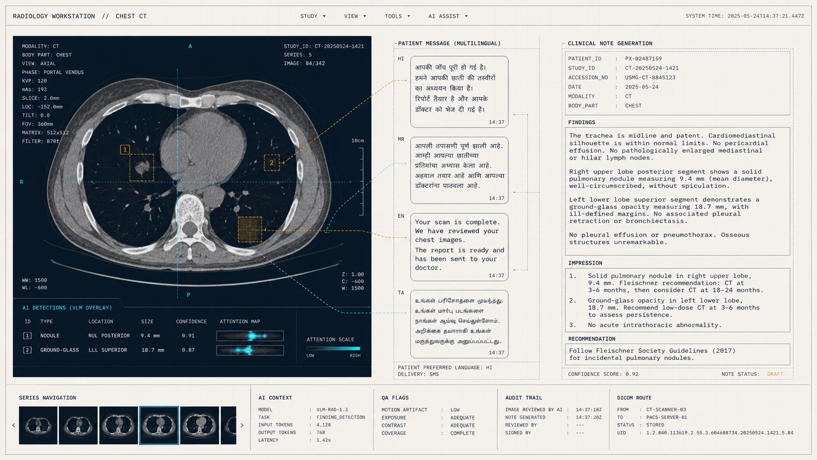 Medical-imaging VLM and clinical documentation copilot — chest CT radiology workstation
