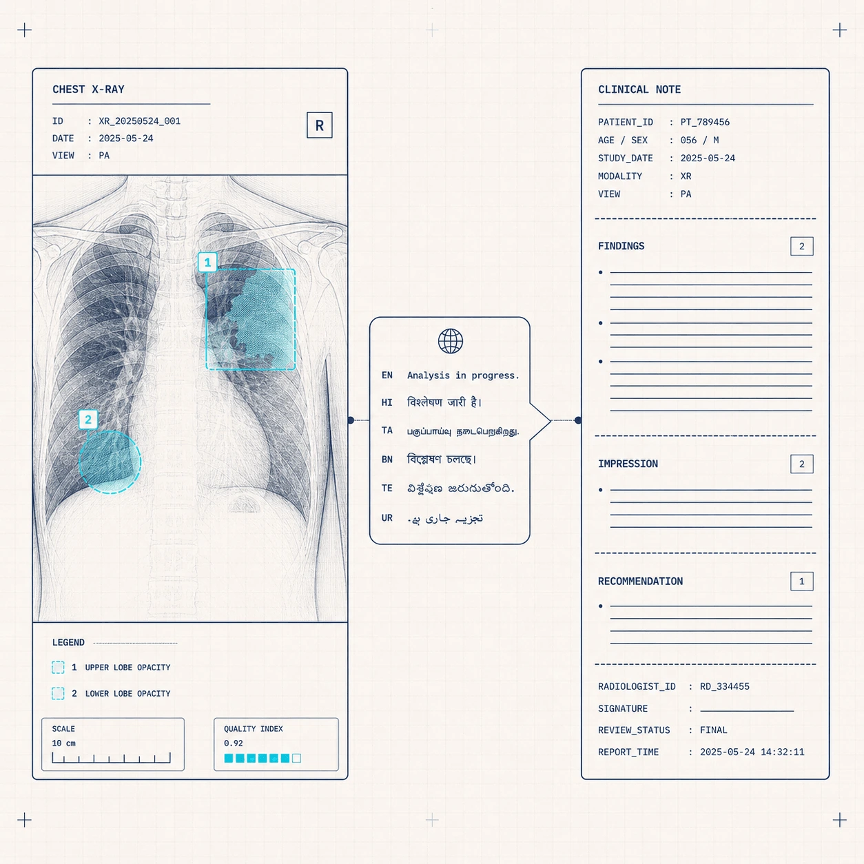 Healthcare and life sciences — chest X-ray reading with AI-flagged regions and multilingual clinical note generation